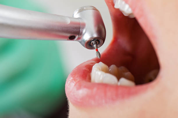 Best Emergency Broken Tooth Repair in Lloyd Harbor, NY